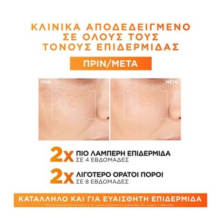 L'OREAL | Ορός προσώπου Revitalift Clinical με Βιταμίνη C 30ml