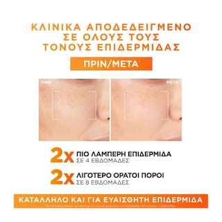 L'OREAL | Ορός προσώπου Revitalift Clinical με Βιταμίνη C 30ml