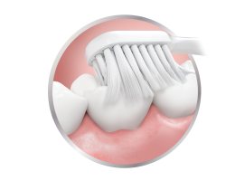 PARODONTAX | Οδοντόβουρτσα Interdental Extra Soft 1 Τεμάχιο