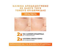 L'OREAL | Ορός προσώπου Revitalift Clinical με Βιταμίνη C 30ml